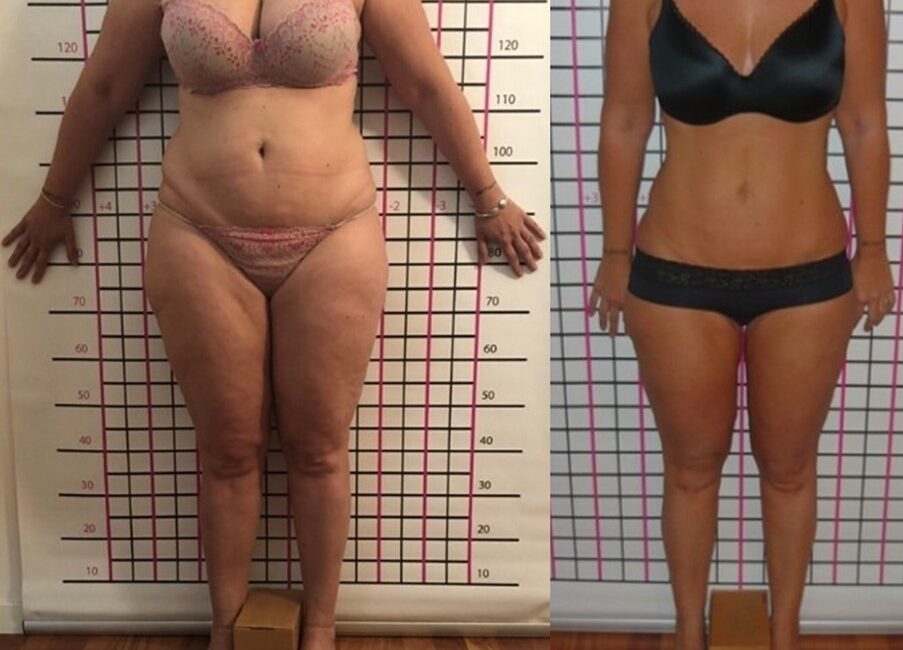DIMAGRIMENTO DONNA 24 KG DIMAGRIMENTO DONNA 24 KG